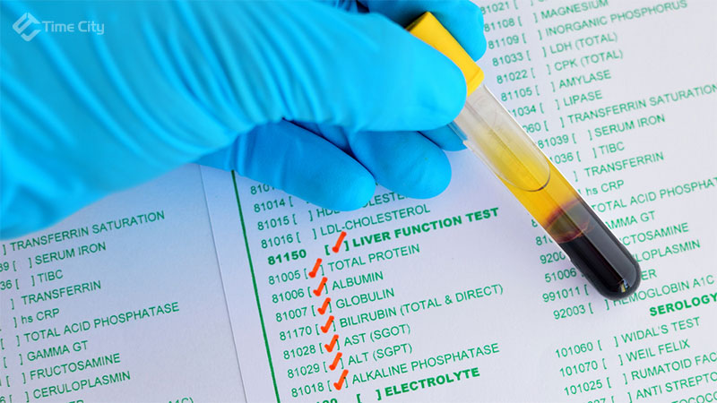 Liver function test