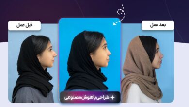 رونمایی از شبیهساز جراحی بینی؛ تحولی در زیبایی با هوش مصنوعی 23 رونمایی از شبیهساز جراحی بینی؛ تحولی در زیبایی با هوش مصنوعی